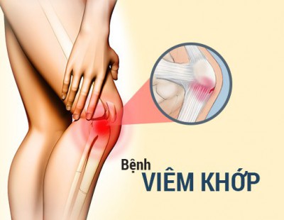 Cách phát hiện sớm và chính xác bệnh viêm khớp